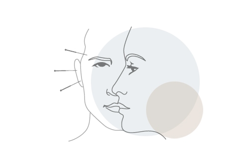 Akupunktur und Akupressur - Leistungen von Julia Schwackhöfer, Praxis für Naturheilkunde und Microkinesitherapie